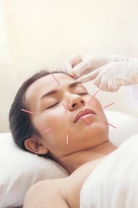 acupuncture face pain relief